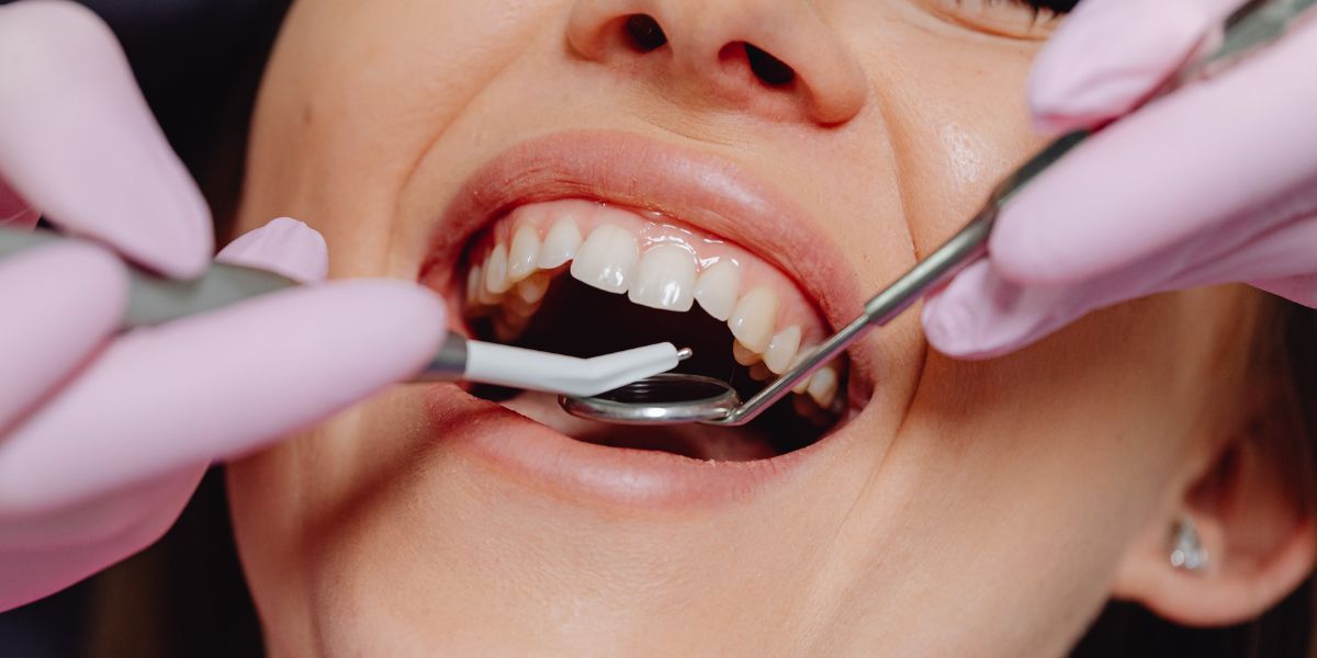 How Cosmetic Dentistry Can Boost Your Confidence